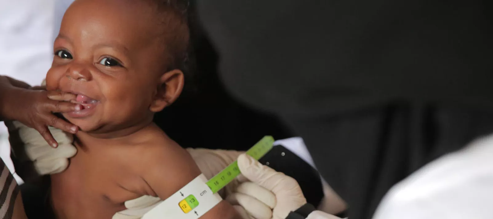 A baby is measured while being screened for severe acute malnutrition.