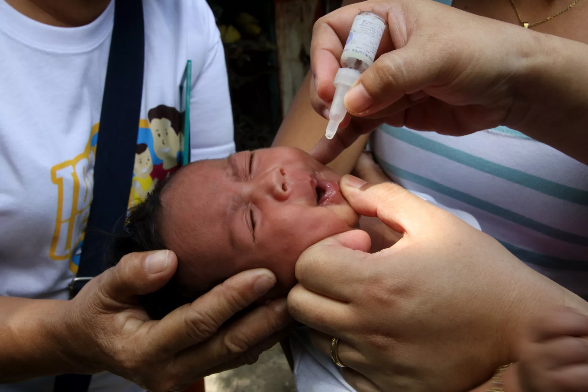 An infant receiving a polio vaccine