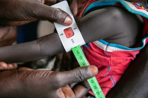 A young girl is screened for malnutrition at Nyong PHCU (Primary Health Care Unit) nutrition site in Torit, South Sudan