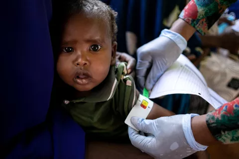 A child has its mid-upper arm circumference measured to gauge for evidence of malnutrition, at Dolow Health Centre in Dolow, Somalia, on 3 February 2022. UNICEF continues their life-saving assistance through drought-affected areas, working with families, local communities, organisations and governments throughout Somalia.