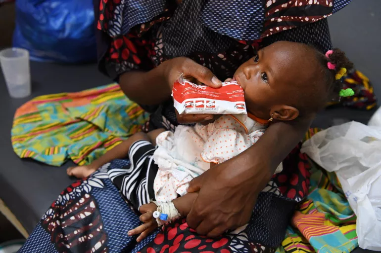 تتلقى مريم، 12 شهرا، غذاء علاجيا جاهز الاستعمال في بوركينا فاسو.