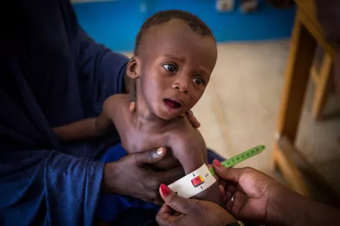 Seated on the lap of his mother, Okachatata Ichaka, 16 months old, is found to be suffering from severe acute malnutrition during a screening at the health center of reference in Gao. 