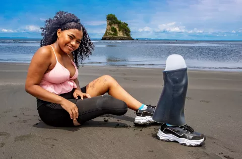 Maribel is sitting on the beach next to her prosthesis