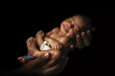 Bébé Kadia de Bougouni est née avec une infection souvent mortelle pour les nouveau-nés. 