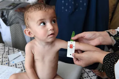 Un enfant est examiné par les médecins, qui diagnostiquent une malnutrition aiguë sévère.