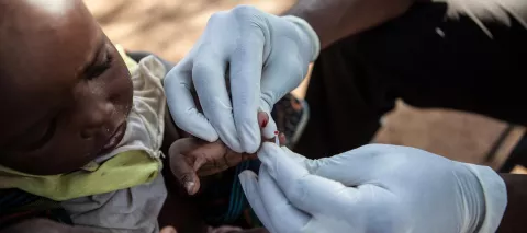 A doctor from the Medical Alliance against Malaria obtains a blood sample from an infant to perform a malaria rapid diagnostic test in the village of Manadougou, in Mali.