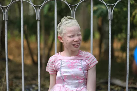 Une jeune fille ayant l'albinisme sourit dehors, en portant des habits roses