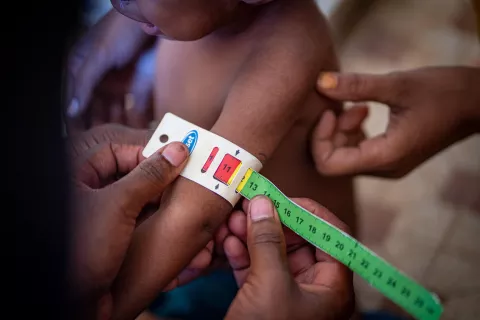 Measurement of the arm circumference of a severely acute malnourished child in order to assess his nutritional status