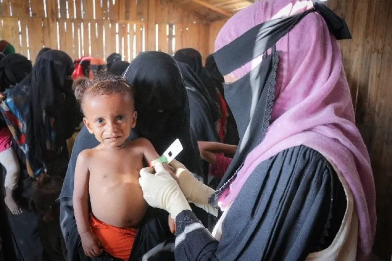 Baby Mohammed is screened for malnutrition by a mobile health team in an IDP centre in Aden